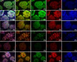 3D-modelling of the adrenal gland and adrenal tumors