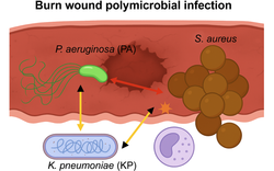 Pathogen - pathogen interactions in polymicrobial infections