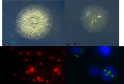 Msc Thesis in Medical Microbiology