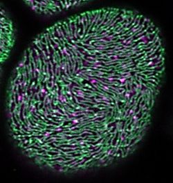 Functional Analysis of Kidney Disease Mechanisms Using the Drosophila melanogaster Nephrocyte Model