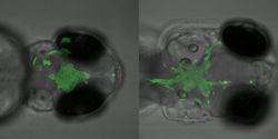 Brain cancer xenograft modeling in zebrafish for preclinical drug testing